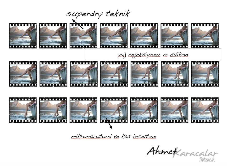 تشكيل الساق تشكيل الساق والنسب الجمالية