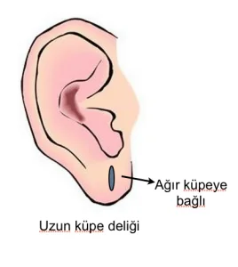 Küpe-deliği-estetiği
