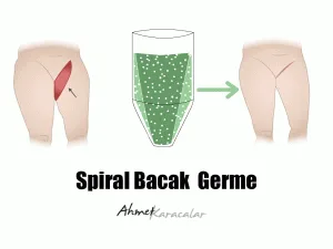 bacak-germe