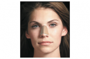 Tamponsuz burun ameliyatı