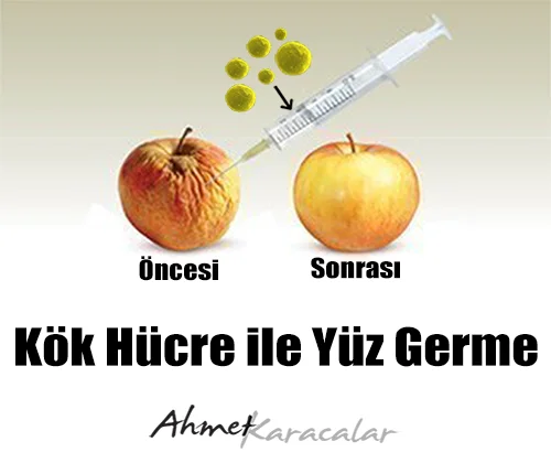 Kök Hücre Tedavisi ve Çeşitleri Diyagramı