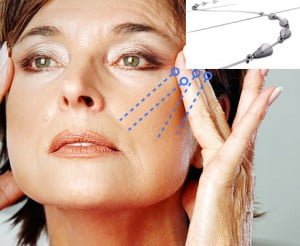 Şemsiye askı semsiye-aski