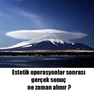 When are the real results obtained after aesthetic operations