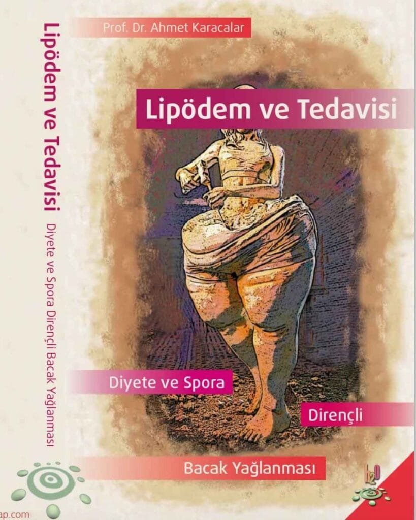 lipödem ve tedavisi ahmet karacalar